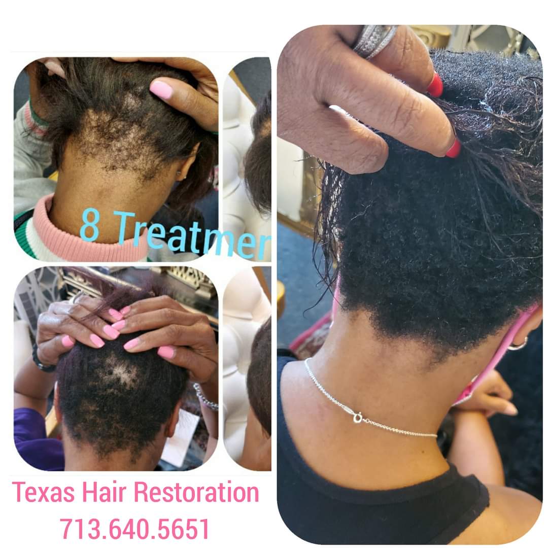 Hair Treatment Service